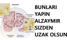 Bunları Yaparsanız Alzheimer ve Bunama Yanınıza Dahi Yaklaşamayacak